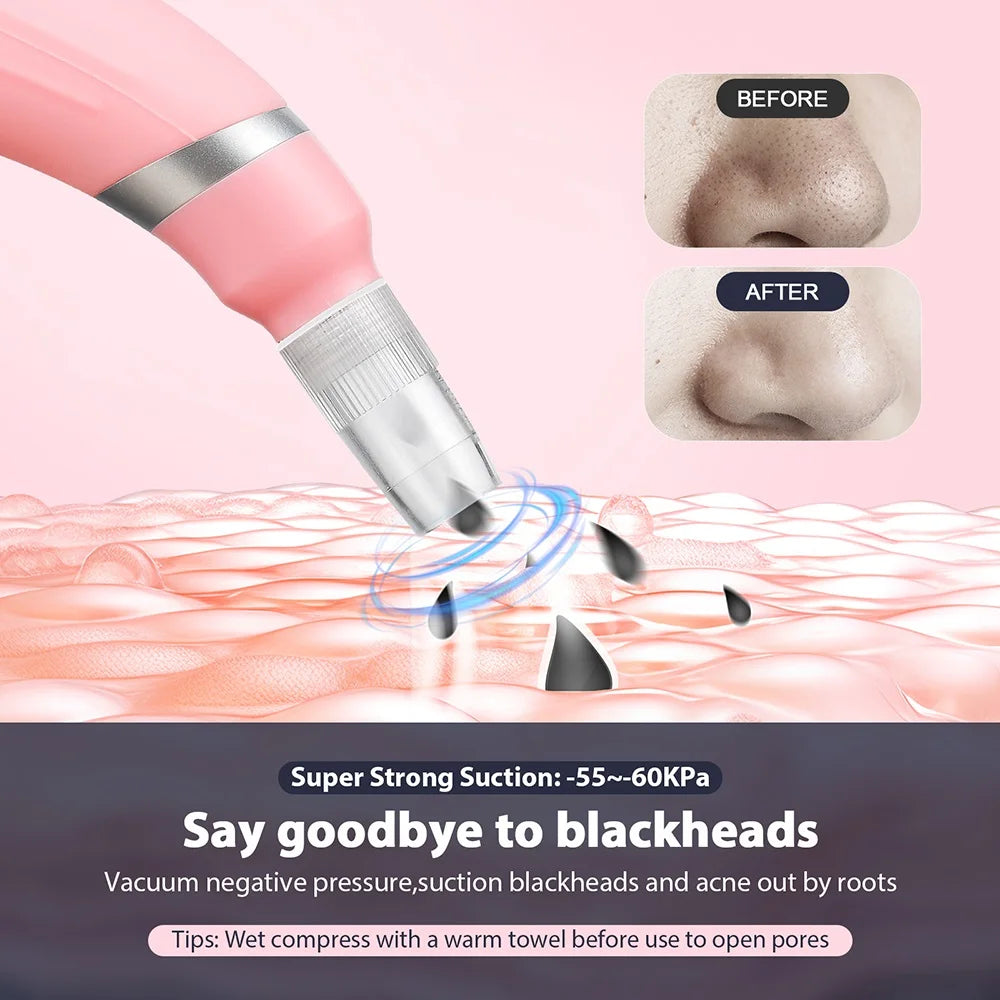 Diamond Peeler Portable Facial Peeling Beauty Meter for Pore Shrinkage Vacuum Blackhead Removal Anti-Aging