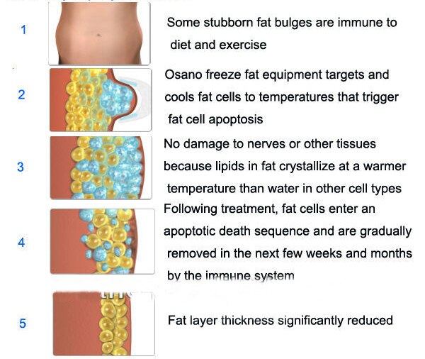 Cryolipolysis Cavitation Cryotherapy Fat Freezing Machine Body Slimming Weight Loss Cold Lipo Anti Cellulite Dissolve Fat Cold