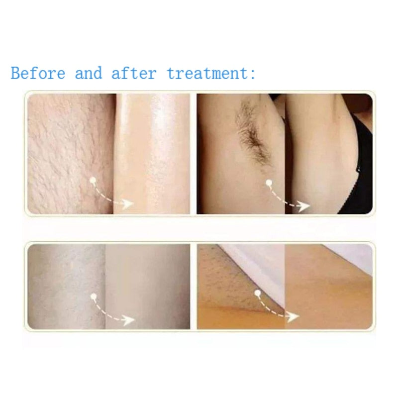 SHR Hair Removal Machine IPL OPT SHR Hair Removal Skin Care Rejuvenation With 480nm 530nm 640nm Filters